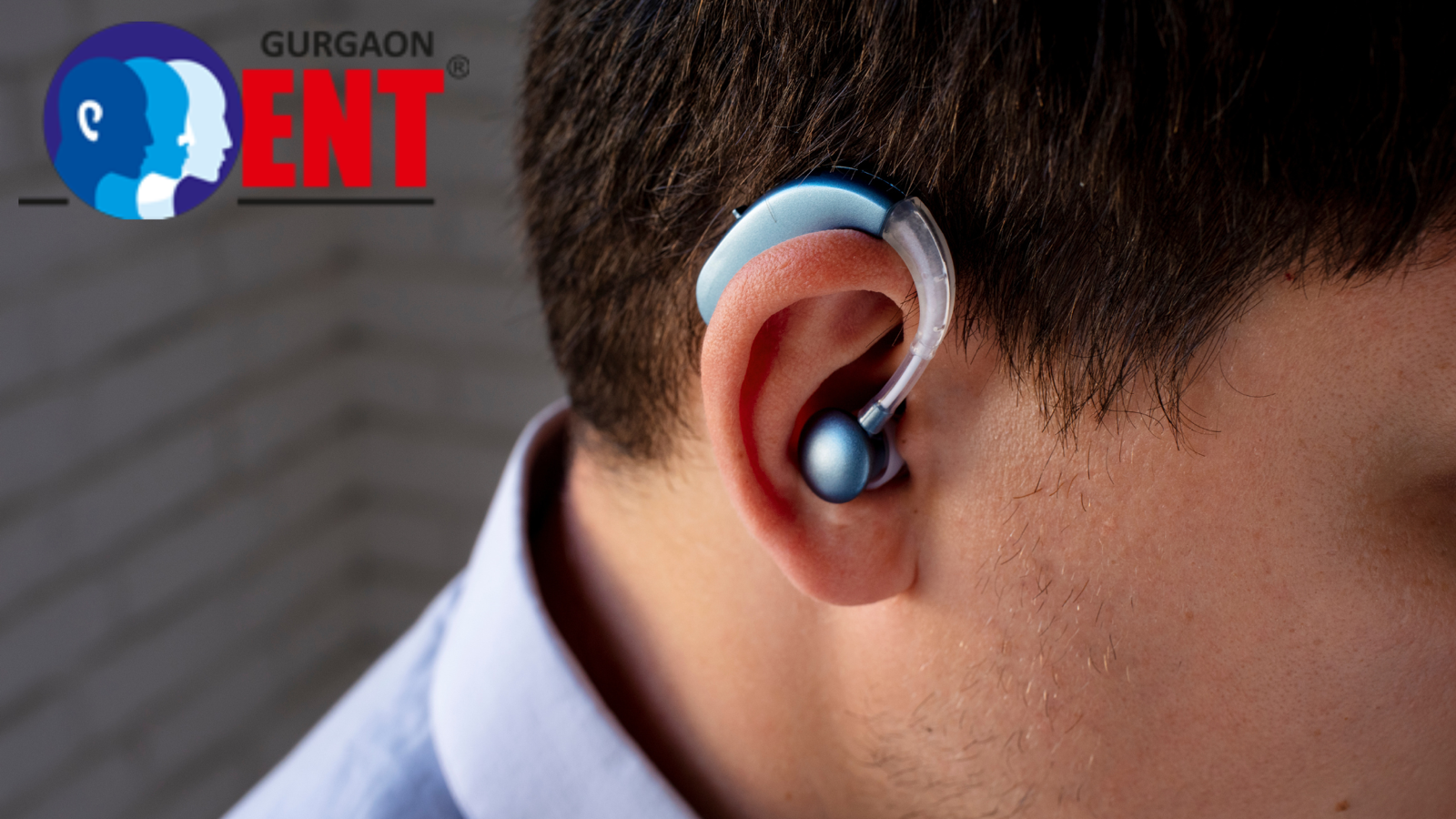How Cochlear Implant Surgery In Gurgaon Transforms Life After Hearing Loss