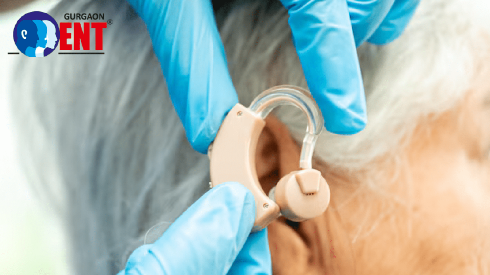 Choosing A Cochlear Implant Surgery Clinic In Gurgaon For Hearing Restoration
