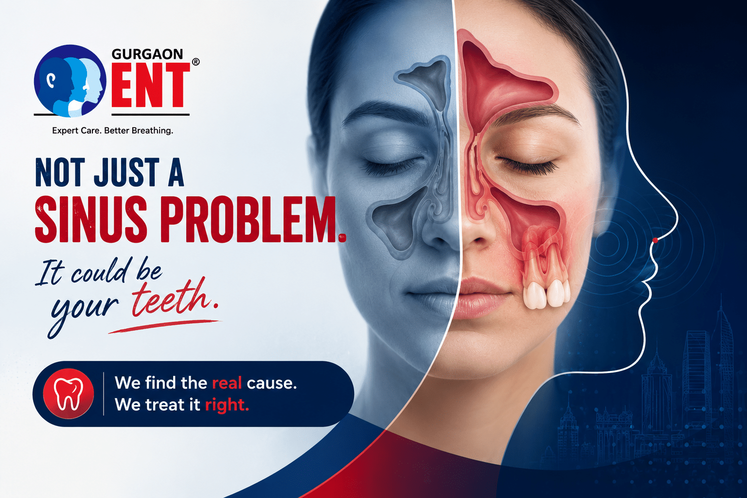 Odontogenic Sinusitis: When Your Teeth Cause It And How A Sinus Surgeon Fixes It