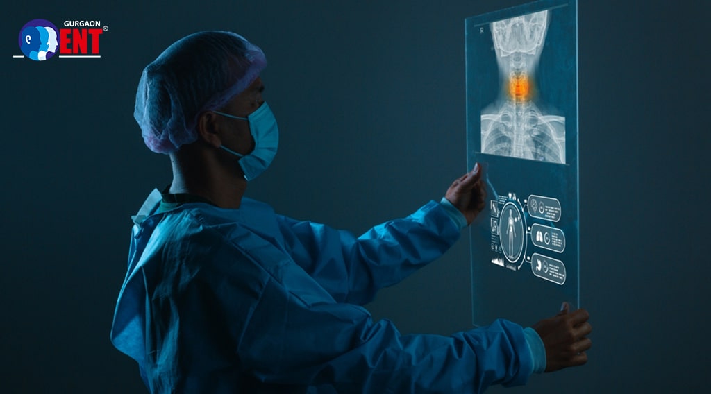 Head And Neck Cancer Surgery: Types, Symptoms And Key Facts