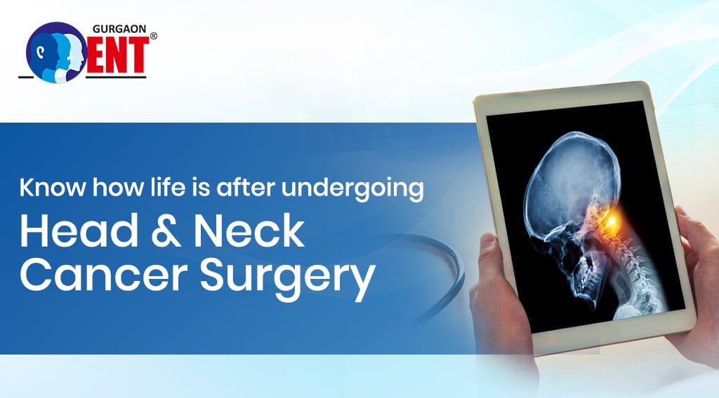 Life After Head & Neck Cancer Surgery: What To Expect