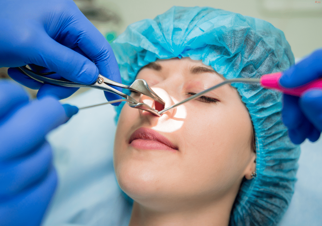 Endoscopic Surgery