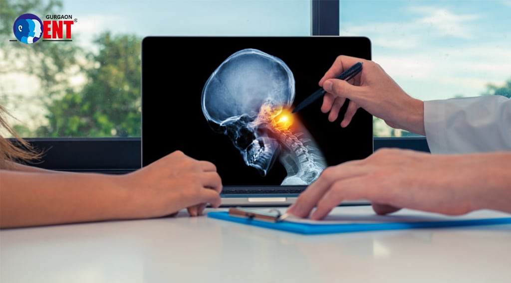 Why Head & Neck Cancer Surgery In Gurgaon Offers The Best Path To Recovery