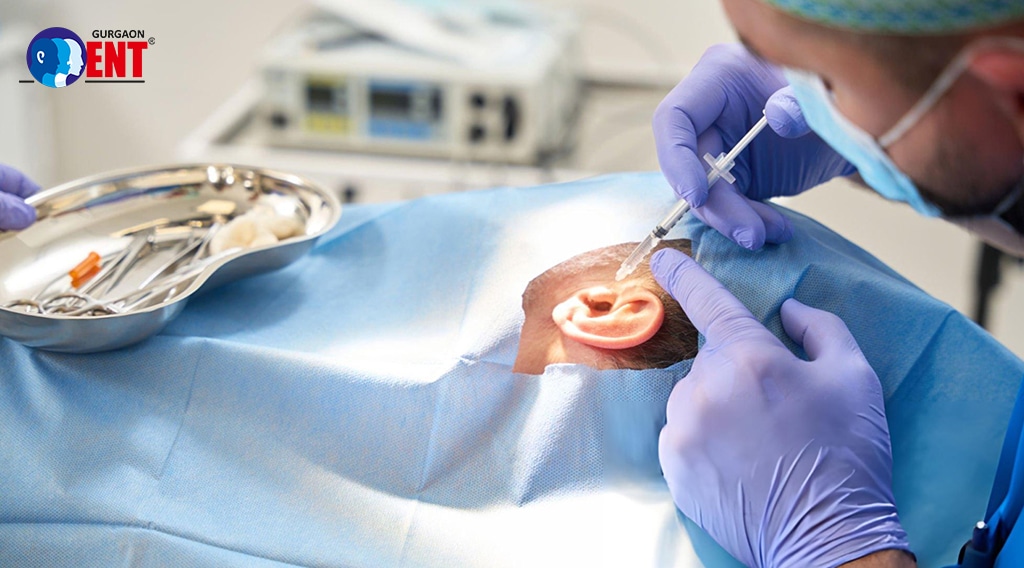 Microear Surgery In Gurgaon: Improving Hearing Health With Innovative Techniques