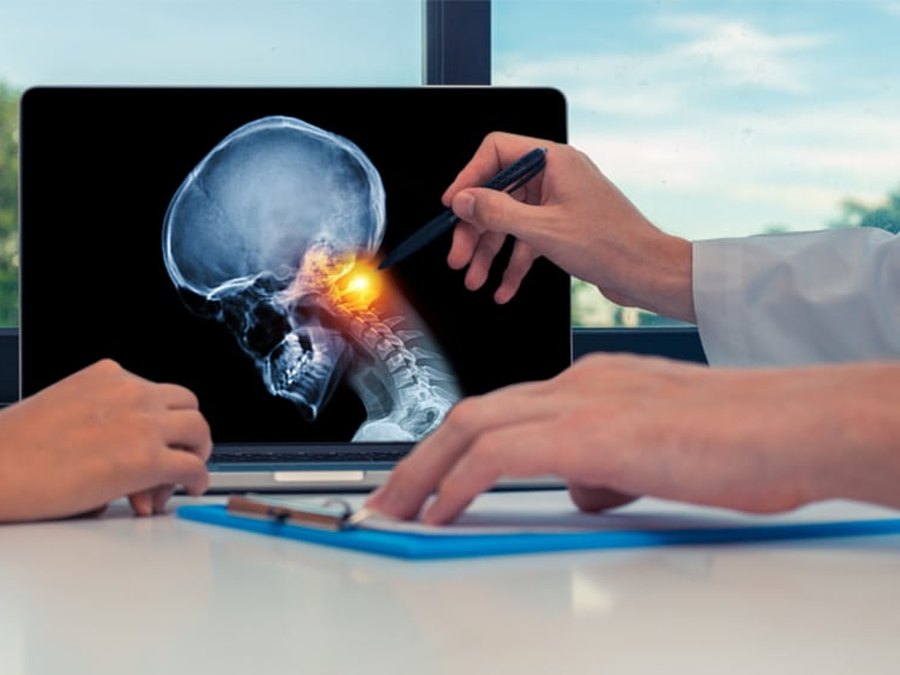 Skull and cervical spine imaging reviewed during a skull base surgery consultation